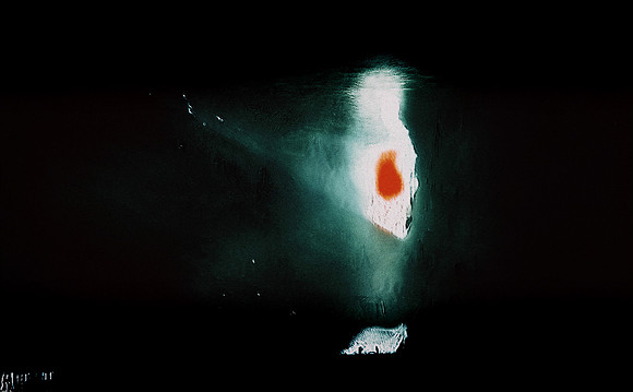 15-62