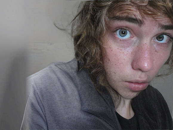 17-25