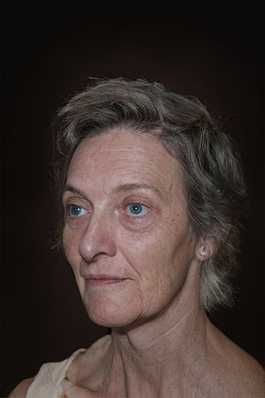 172-18