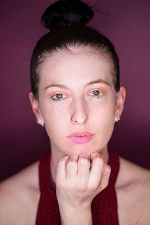160-20