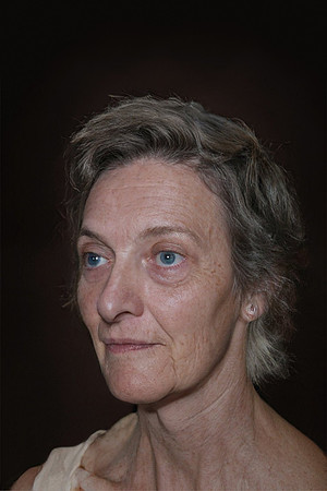 172-18