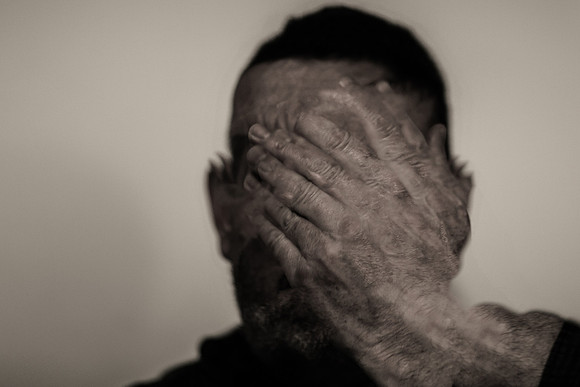 the 5 stages of a migraine #1