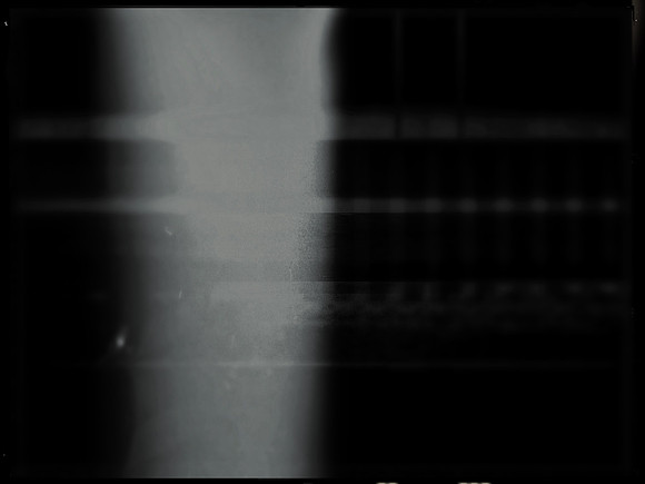 34-70