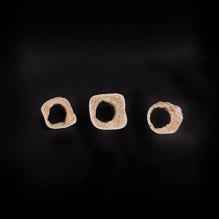 bone scan