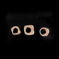 bone scan