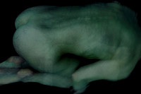 250314 #176-18-2
