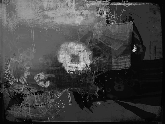 15-25
