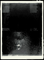 41-2