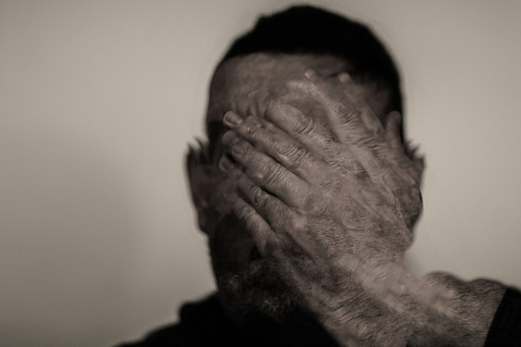 the 5 stages of a migraine #1