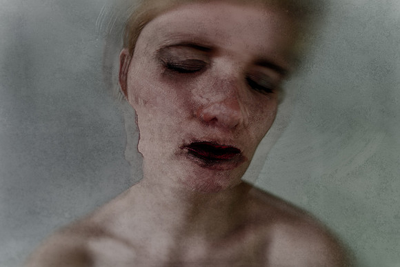 190314/301