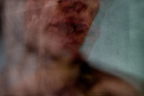 190314 #409-6-2